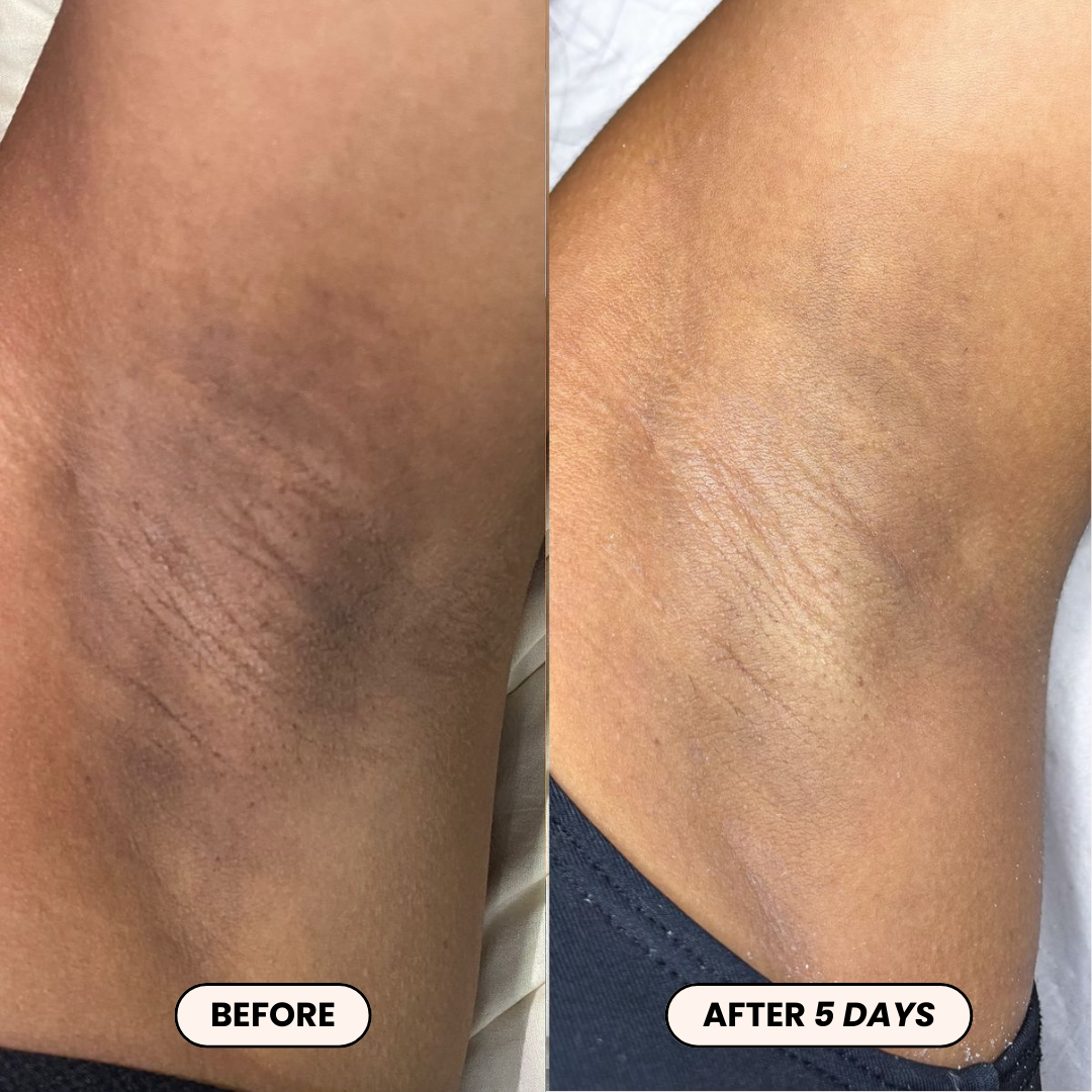 Dr. Melaxin PeelShot™ Kojic Acid & Turmeric Brightening Spray