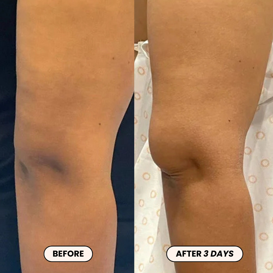 Dr. Melaxin PeelShot™ Kojic Acid & Turmeric Brightening Spray