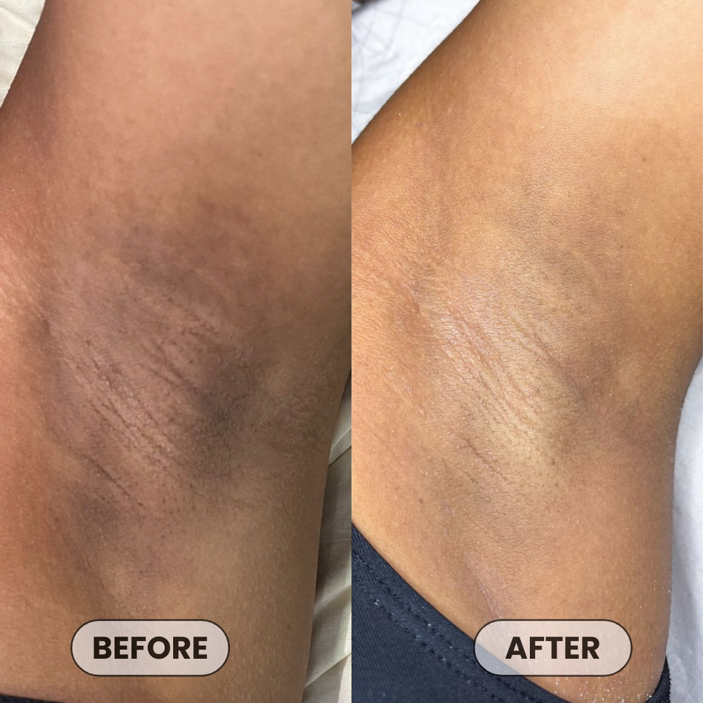 <p>Loved by 24,801+ Happy Babes</p>