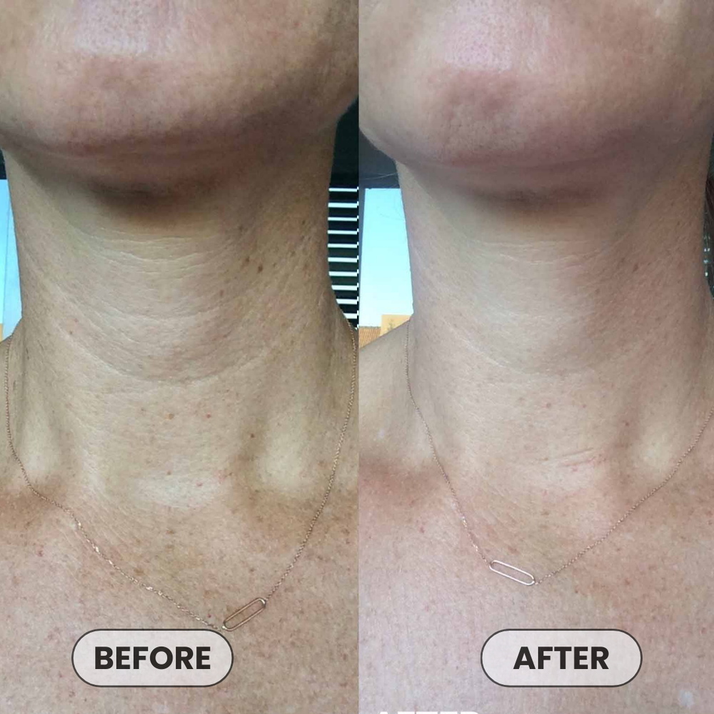 <p>Loved by 24,801+ Happy Babes</p>